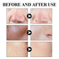West Month Blackhead Removal Mud Mask for Oil Control and Pores