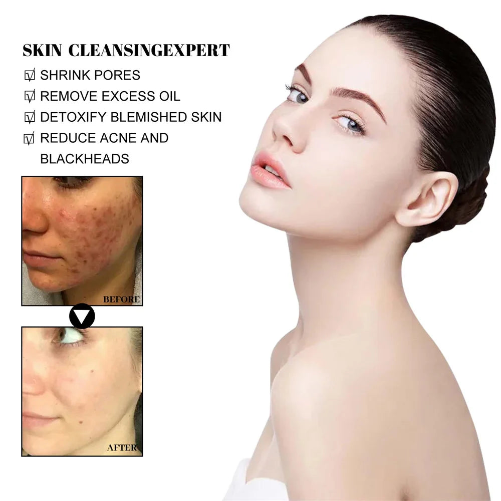 West Month Blackhead Removal Mud Mask for Oil Control and Pores